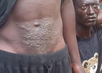 SANTE- Le gouvernement  communique sur le cas de la mystérieuse maladie qui a frappé des pêcheurs artisanaux…