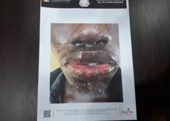 Des pêcheurs touchés par une maladie mystérieuse (gouvernement)