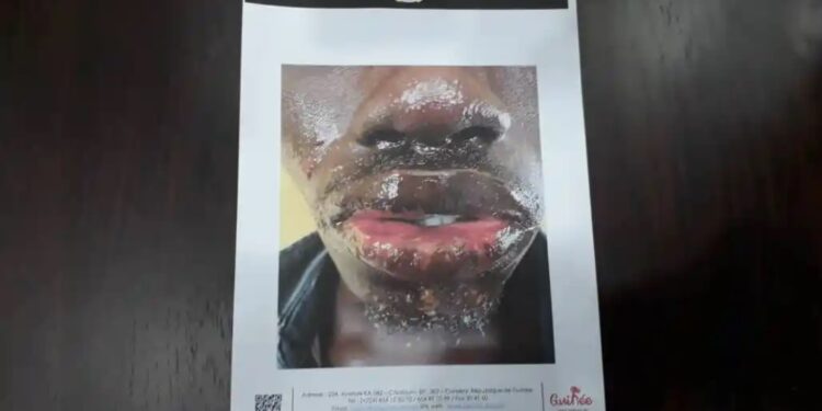 Des pêcheurs touchés par une maladie mystérieuse (gouvernement)