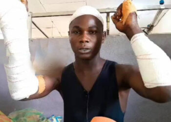 ACTUALITES- Affrontement meurtrier à Gbérédou Baranama : le témoignage bouleversant de Kaba Condé, survivant d&rsquo;une nuit de violence