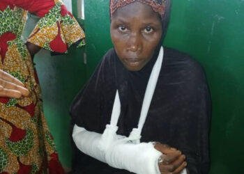 ACTUALITES- Mamou : En pleine nuit, un père de famille brise les deux bras de sa femme dans une violente agression