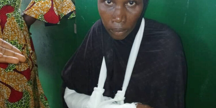 ACTUALITES- Mamou : En pleine nuit, un père de famille brise les deux bras de sa femme dans une violente agression