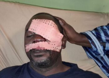 ACTUALITES- Quand la colère aveugle : un journaliste perd un œil sur l’axe